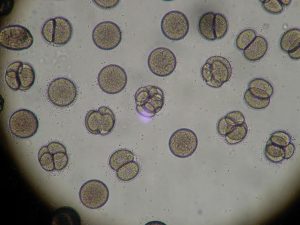 microscope, sea urchin, egg splitting, embryo, science, lab, cell, laboratory, biology, research, scientific, technology, test, experiment, biotechnology, cells biology, student, bio, micro, microbiology, scientist, dna, researcher, medical research, equipment, life, sample, education, analysis, study, gray education, gray medical, gray life, gray science, gray study, gray egg, gray research, gray eggs, gray studying, gray lab, gray test, gray laboratory, embryo, embryo, embryo, embryo, embryo